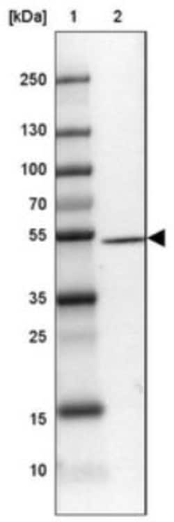DENN/MADD Domain Containing 2D Antibody, Novus Biologicals 0.1mL; Unlabeled:Antibodies,