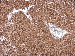 DENR Antibody, Novus Biologicals 0.1mL; Unlabeled:Antibodies, Polyclonal
