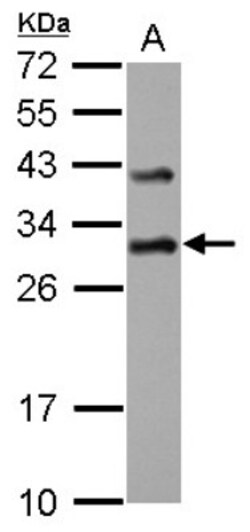 DENR Antibody, Novus Biologicals 0.1mL; Unlabeled:Antibodies, Polyclonal