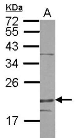 DENR Antibody, Novus Biologicals 0.1mL; Unlabeled:Antibodies, Polyclonal