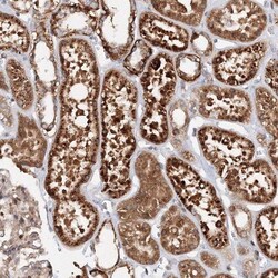 Deoxycytidylate deaminase Antibody, Novus Biologicals 0.1mL; Unlabeled:Antibodies,