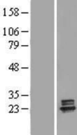 Novus Biologicals&trade;&nbsp;Deoxyguanosine kinase Overexpression Lysate