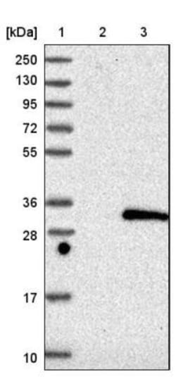 Deoxyguanosine kinase Antibody, Novus Biologicals 0.1mL; Unlabeled:Antibodies,