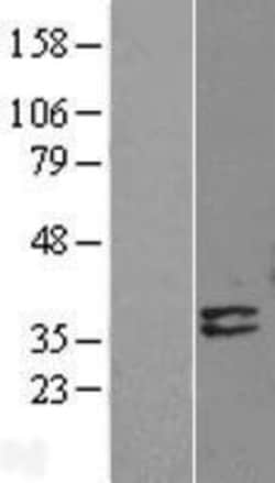 Novus Biologicals&trade;&nbsp;Deoxyribonuclease I like 1 Overexpression Lysate