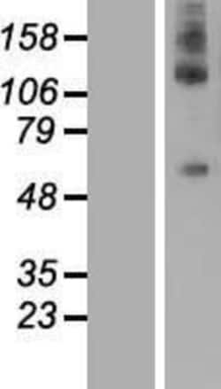 Novus Biologicals&trade;&nbsp;DEPDC1A Overexpression Lysate