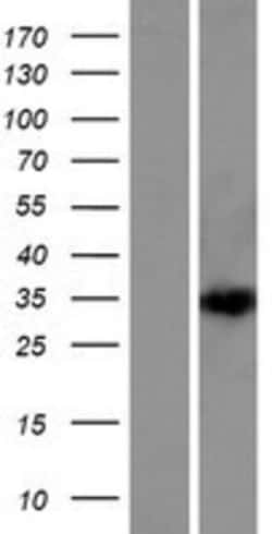 Novus Biologicals™ DEPDC4 Overexpression Lysate