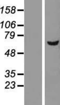 Novus Biologicals&trade;&nbsp;DEPDC7 Overexpression Lysate