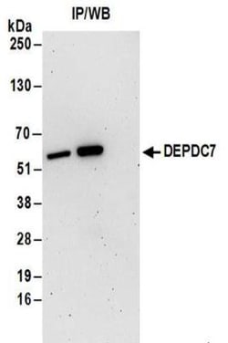 DEPDC7 Antibody, Novus Biologicals 0.1mg; Unlabeled:Antibodies, Polyclonal