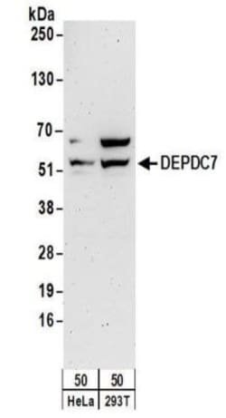 DEPDC7 Antibody, Novus Biologicals 0.1mg; Unlabeled:Antibodies, Polyclonal