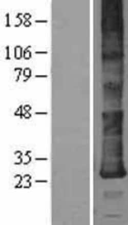 Novus Biologicals&trade;&nbsp;Derlin-2 Overexpression Lysate