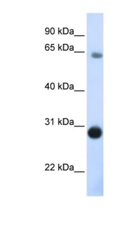Derlin-3 Antibody, Novus Biologicals 0.05mg; Unlabeled:Antibodies, Polyclonal