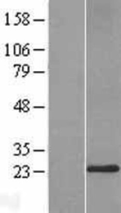 Novus Biologicals&trade;&nbsp;Derlin-3 Overexpression Lysate