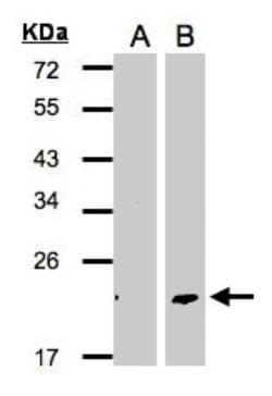 Dermatopontin Antibody, Novus Biologicals 0.1mL; Unlabeled:Antibodies,