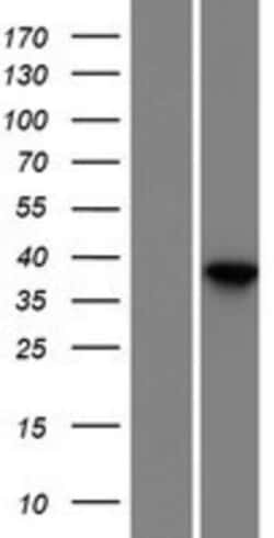 Novus Biologicals™ Dermokine beta Overexpression Lysate