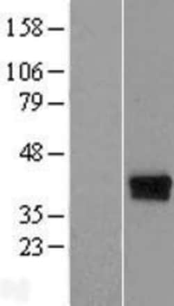 Novus Biologicals™ DERP6 Overexpression Lysate