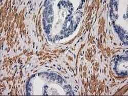 Desmin Antibody (OTI4G1), Novus Biologicals 0.1mL; Unlabeled:Antibodies,