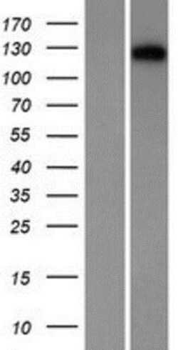 Novus Biologicals&trade;&nbsp;Desmocollin-1 Overexpression Lysate