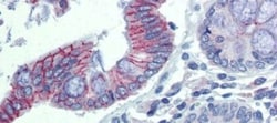 Desmoglein-2 Antibody, Novus Biologicals 0.05mg; Unlabeled:Antibodies,