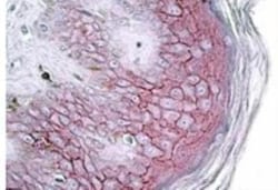 Desmoglein-1 Antibody, Novus Biologicals 0.1mg; Unlabeled:Antibodies, Polyclonal