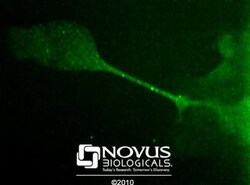Desmoglein-3 Antibody (5G11) - BSA Free, Novus Biologicals:Antibodies:Primary