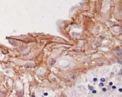 Desmoglein-3 Antibody (5G11) - BSA Free, Novus Biologicals:Antibodies:Primary