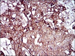 Desmoglein-3 Antibody (6G2C11) - BSA Free, Novus Biologicals 0.1mL; Unlabeled:Antibodies,