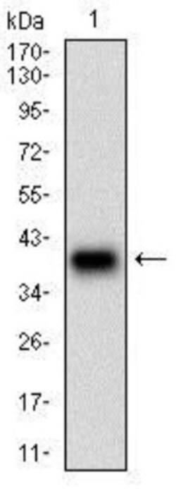 Desmoglein-3 Antibody (6G2C11) - BSA Free, Novus Biologicals 0.1mL; Unlabeled:Antibodies,