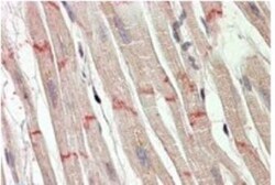 Desmoplakin Antibody, Novus Biologicals 0.1mg; Unlabeled:Antibodies, Polyclonal