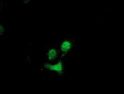 Destrin Antibody (OTI2F7), Novus Biologicals 0.1mL; Unlabeled:Antibodies,