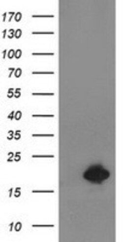 Destrin Antibody (OTI2F7), Novus Biologicals 0.1mL; Unlabeled:Antibodies,