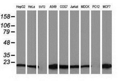 Destrin Antibody (OTI2F7), Novus Biologicals 0.1mL; Unlabeled:Antibodies,