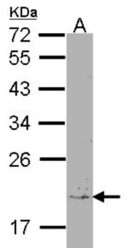 Destrin Antibody, Novus Biologicals 0.1mL; Unlabeled:Antibodies, Polyclonal