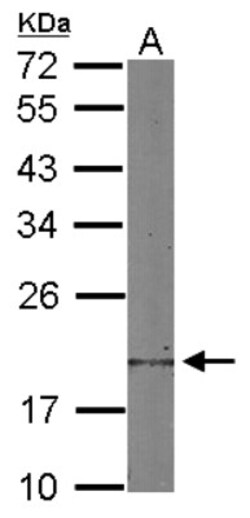 Destrin Antibody, Novus Biologicals 0.1mL; Unlabeled:Antibodies, Polyclonal
