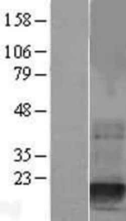 Novus Biologicals™ Destrin Overexpression Lysate