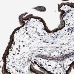 Dfna5 Antibody, Novus Biologicals:Antibodies:Primary Antibodies