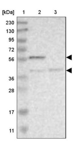 Dfna5 Antibody, Novus Biologicals:Antibodies:Primary Antibodies