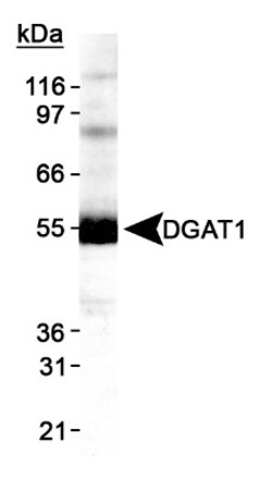 DGAT1 Antibody - BSA Free, Novus Biologicals 0.1mL; Unlabeled:Antibodies,