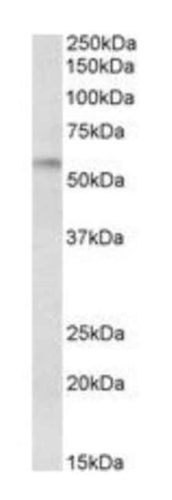 DGAT1 Antibody, Novus Biologicals 0.1mg; Unlabeled:Antibodies, Polyclonal