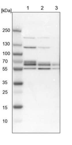 DGCR14 Antibody, Novus Biologicals 0.1mL; Unlabeled:Antibodies, Polyclonal