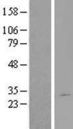 Novus Biologicals&trade;&nbsp;DGCR6L Overexpression Lysate