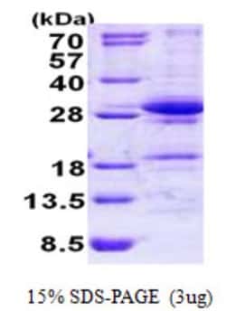 Novus Biologicals&trade;&nbsp;Recombinant Human DGCR6L His Protein