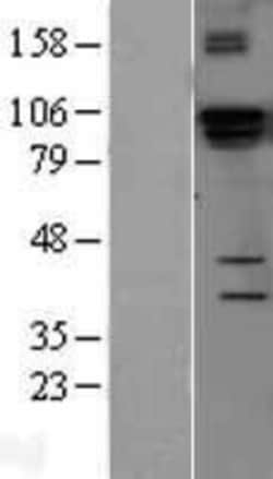 Novus Biologicals&trade;&nbsp;DGCR8 Overexpression Lysate