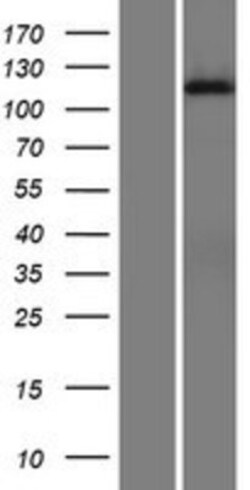 Novus Biologicals&trade;&nbsp;DGK-iota Overexpression Lysate