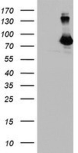 anti-DGK-alpha, Clone: 4A11, Novus Biologicals 0.1mL; Unlabeled, Quantity: