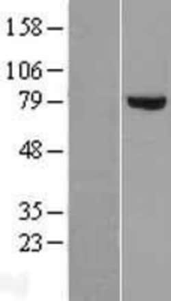 Novus Biologicals&trade;&nbsp;DGK-alpha Overexpression Lysate