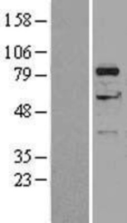 Novus Biologicals&trade;&nbsp;DGK-alpha Overexpression Lysate