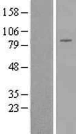 Novus Biologicals DGK-beta Overexpression Lysate 0.1 mg | Buy Online | Novus Biologicals&trade; | Fisher Scientific