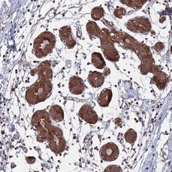 DGK-delta Antibody, Novus Biologicals:Antibodies:Primary Antibodies
