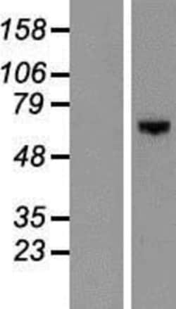 Novus Biologicals&trade;&nbsp;DGK-epsilon Overexpression Lysate