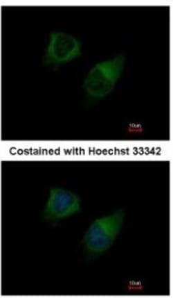 DGK-gamma Antibody, Novus Biologicals 0.1mL; Unlabeled:Antibodies, Polyclonal